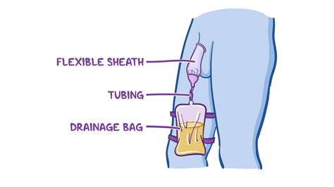 Condom Catheters Clinical Skills Notes Osmosis