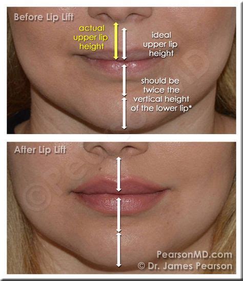 Search, discover and share your favorite g flip meme gifs. Lip Proportion - Upper Lip : Lower Lip The vertical height ...