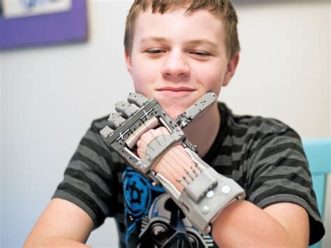 E Nables 3d Printed Prostheses For Kids Bloomberg