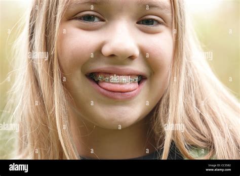 Lächelnd Jugendlicher Mädchen Mit Zahnspangen Stockfotografie Alamy