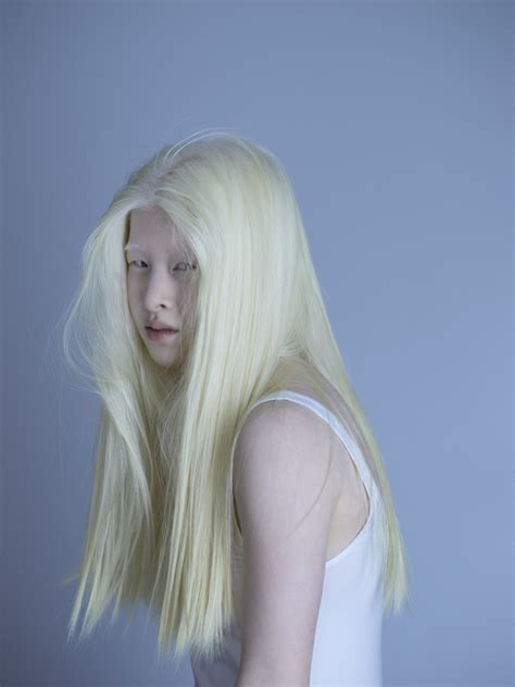 Albino Blonde Telegraph
