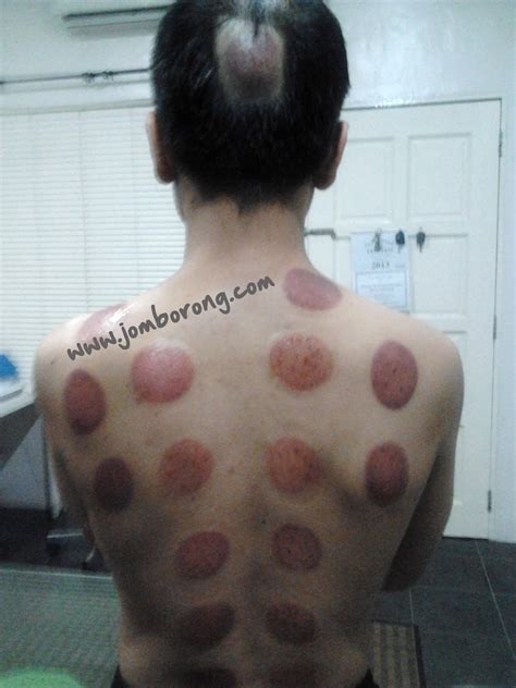 We did not find results for: Pembekal Alat Bekam | Harga borong | 12 cup set & 6 cup ...