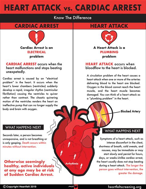 Sudden cardiac arrest (sudden cardiac death). Sudden Cardiac Arrest (SCA) - Heartfelt