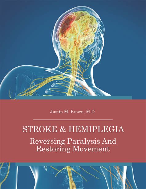 Stroke Hemiplegia Treatment Patient Guide Download — Paralysis Center