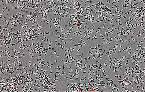 As long as they are kept in enriched medium, the entire cell appears intact and functional. T cell culture problem, big and irregular (elongated ...