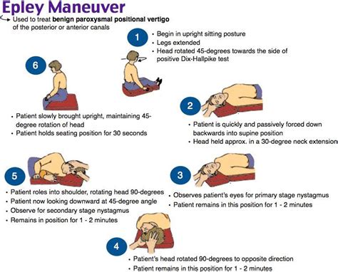 Epley Manöver Modified Epley Maneuver For Treating Right