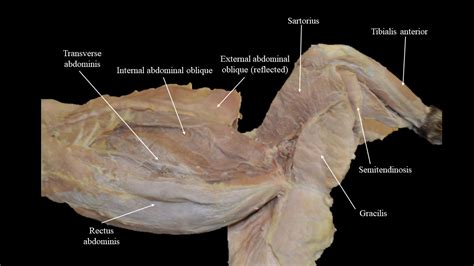 Cat Musculature Atlas Of Comparative Vertebrate Anatomy