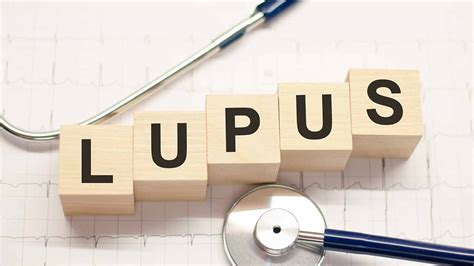 Natural Approaches To Manage Lupus With Functional Medicine