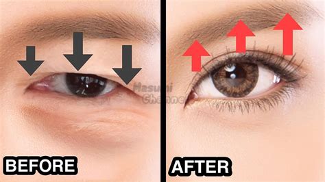 20 Mins Big Eyes Exercise Fast Results Lift Droopy Eyelids Make