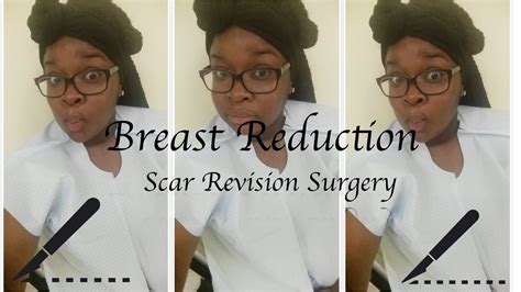 Breast Reduction Scar Revision Surgery Youtube