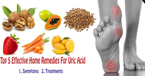 Effective Home Remedies To Uric Acid Cure Naturally