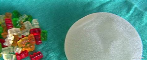 Gummy Bear Breast Implants Karleesmithcom