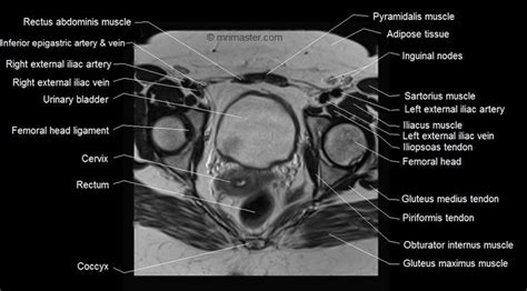Mri Female Pelvis Anatomy Axial Image 20 Pelvis Anatomy Rectus