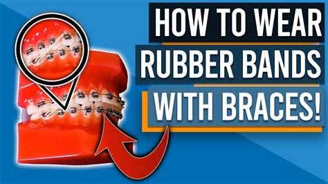 How To Wear Rubber Bandselastics With Braces Youtube
