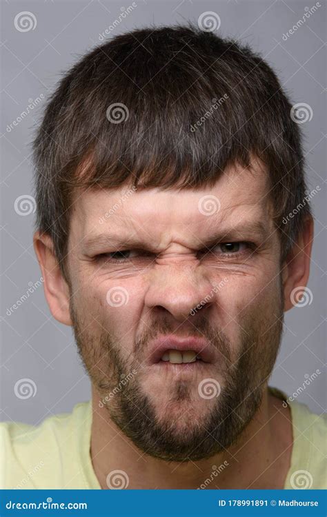 Closeup Portrait Of An Ugly Man Of European Appearance Stock Image