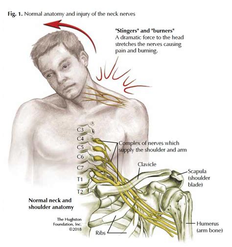 Diagram Of Bones In Neck And Shoulder Anatomy Of The Neck Causes Of Images