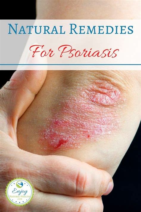 tipps für sex mit psoriasis haut probleme and behandlungen 2024