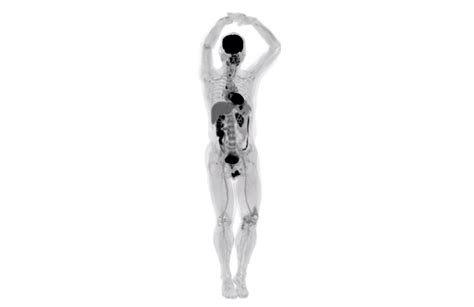 This Total Body Scanner Shows 3d Images Of The Whole Body Medical