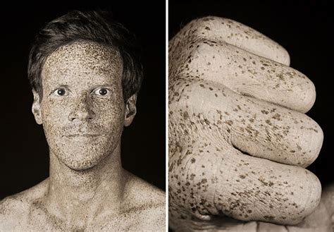 Uv Portraits Showed How Sunlight Damages The Skin Earth Chronicles News