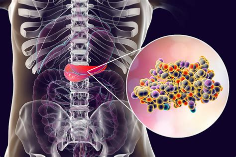 Human Pancreas And Insulin Molecule Bild Kaufen 12921512 Science