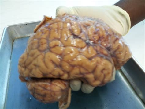 Real Human Brain