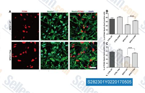 Tideglusib 购买gsk 3 抑制剂 Selleck