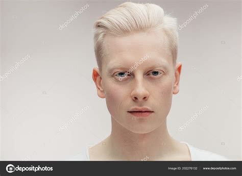 Topo 62 Foto Modelo Albino Vn