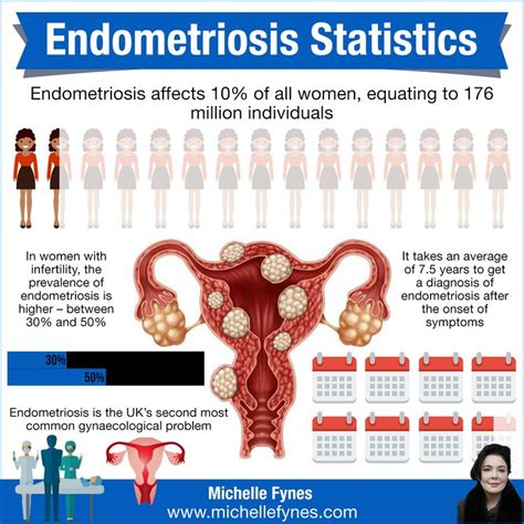 Endometriosis Statistics Endometriosis Obstetrician Gynecology
