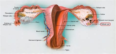 ovarian cysts and pelvic masses cigc