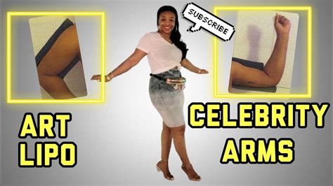I Got A Celebrity Arms Consultation Art Lipo Arm Liposuction Youtube