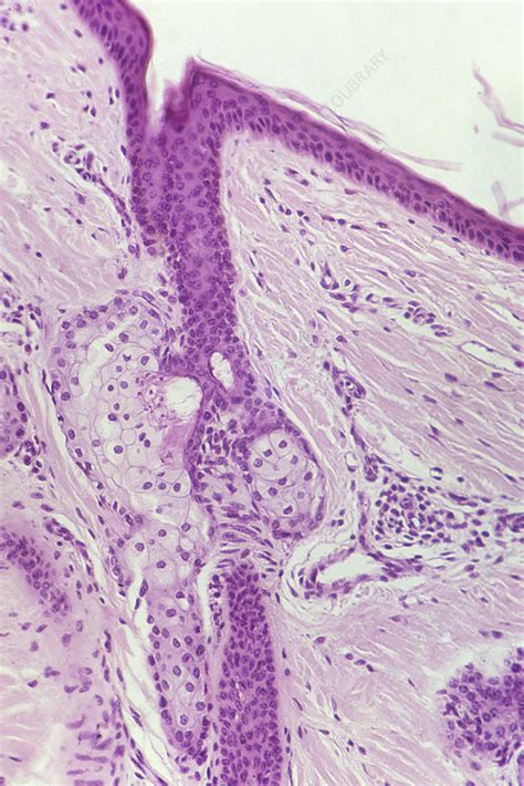 Sebaceous Gland And Hair Follicle Lm Stock Image C0062958