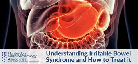 Understanding Irritable Bowel Syndrome And How To Treat It Hunterdon
