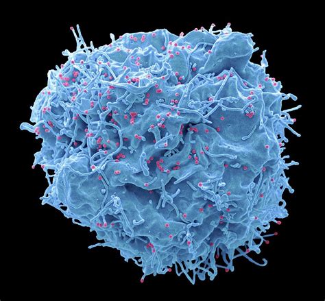Hiv Infected Cell Photograph By Steve Gschmeissner Science Photo Library Pixels