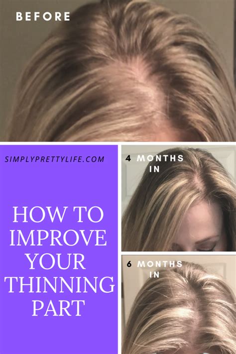 Take Charge Of Your Thinning Hair ⋆ Simply Pretty Life In 2021 Thin