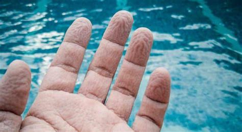 Perché le dita in acqua si raggrinziscono Cosa ha scoperto la scienza