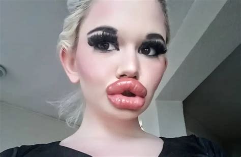 es la mujer con los labios “más grandes del mundo” tiene más de 20 cirugías y quiere parecerse