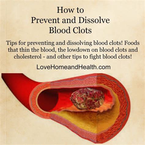 Blood Clots Natural Health Remedies