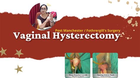 Vaginal Hysterectomy And Pelvic Floor Reconstruction In A Patient With Previous Fothergill S