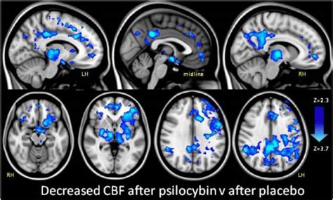 Psilocybin Brain Scan1 Psychedelic Frontier