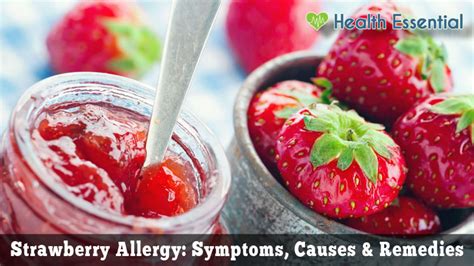 Strawberry Allergy Symptoms Causes And Treatment