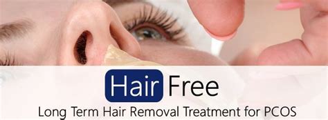 Long Term Hair Removal Treatment For Pcos Hair Free Life