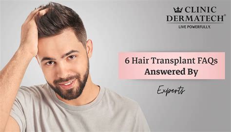 Hair Transplant Faqs Answered By Experts Clinic Dermatech