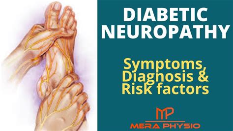Diabetic Neuropathy Symptoms Diagnosis Risk Factors Of Diabetic