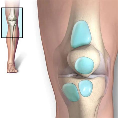 Bursitis Knee Pain Carolinas Pain Center Pain Relief Options Hot Sex