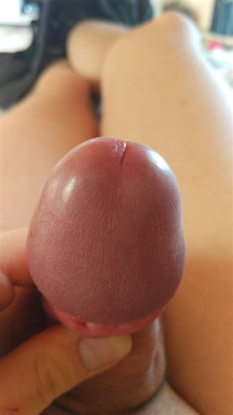 Close Up Mushroom Head Cock Gay Amateur Porn F Xhamster Hot Sex Picture