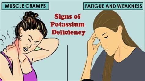 8 Signs And Symptoms Of Potassium Deficiency Hypokalemiasymptoms Of