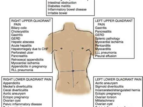 The four quadrants are the four different types of romance recognized by trolls, first explained through exposition here. and the Picture Of Abdominal Quadrants human abdomen is divided into regions by anatomists and ...