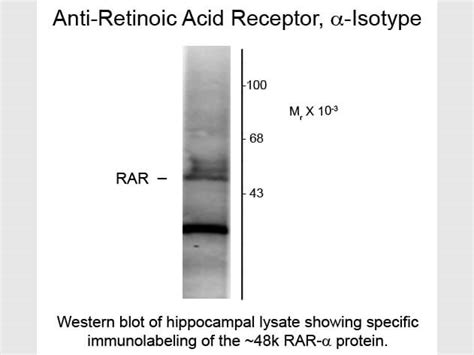 Retinoic Acid Receptor Alpha Antibody 209 301 E25 Rockland
