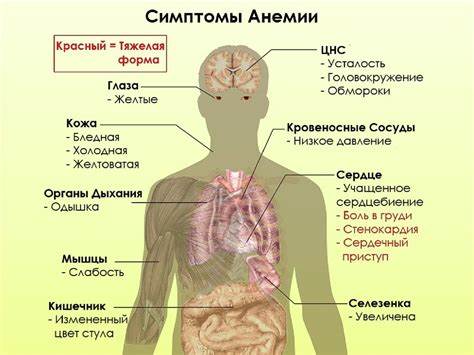 Анемия и желудочно-кишечный тракт | ВКонтакте Картинка - Анемия и желудочно-кишечный тракт | ВКонтакте