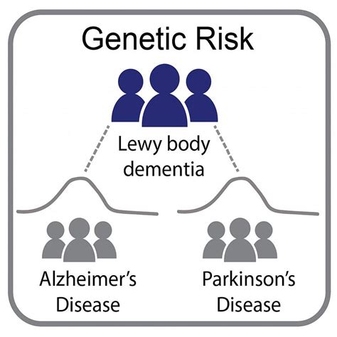 Genetic Study Of Lewy Body Dementia Supports Ties To Alzheimers And
